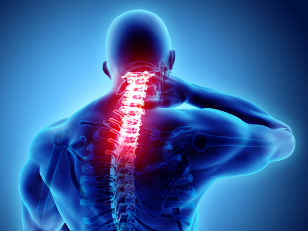 istock Neck painful - cervical spine skeleton x-ray, 3D illustration. 922707140