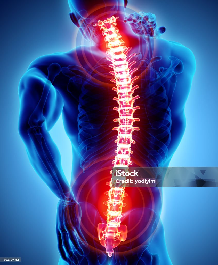 Ilustración en 3D del sacro y dolor cervical. - Foto de stock de Columna - Parte del cuerpo libre de derechos