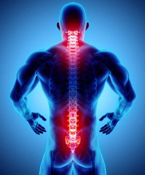 istock 3D Illustration of sacral and cervical painful. 922707156