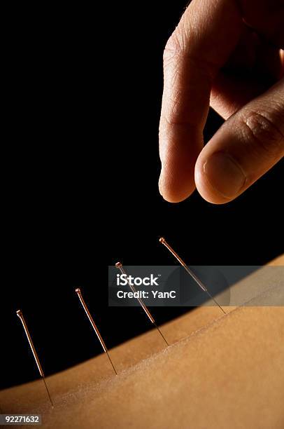 A Hand Placing Acupuncture Pins On Someones Skin Stock Photo - Download Image Now - Acupuncture, Human Face, Acupuncture Needle