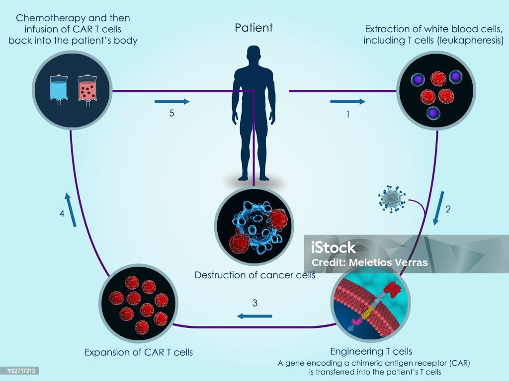 CAR T-cell therapy 3d render of the basic steps of CAR T-cell therapy against cancer T-Cell Stock Photo