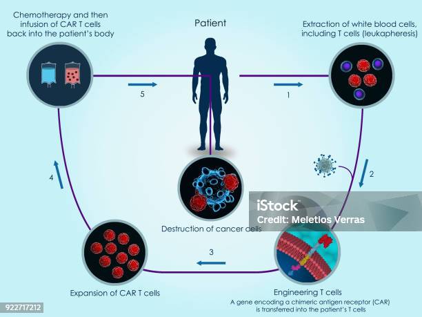 Car Tcell Therapy Stock Photo - Download Image Now - T-Cell, Biological Cell, Gene Therapy