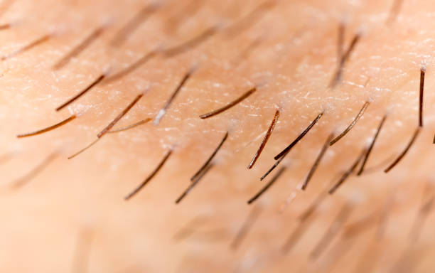 istock Bristles on the beard of a man 922744694