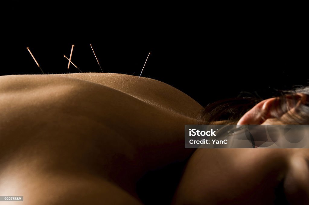 Acupunctura - Royalty-free Acupuntura Foto de stock