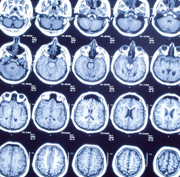 istock Magnetic resonance imaging, medicine concept, old image 922767294