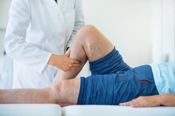 마사지 치료에 고위 여자입니다. - doctor human knee human leg medical exam 뉴스 사진 이미지