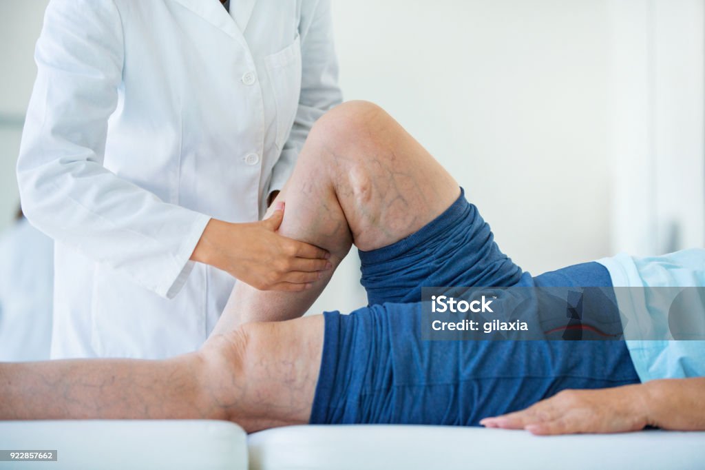 Senior woman in a massage treatment. Closeup side view of unrecognizable female doctor massaging legs and calves of a senior female patient with visible varicose veins. Varicose Vein Stock Photo