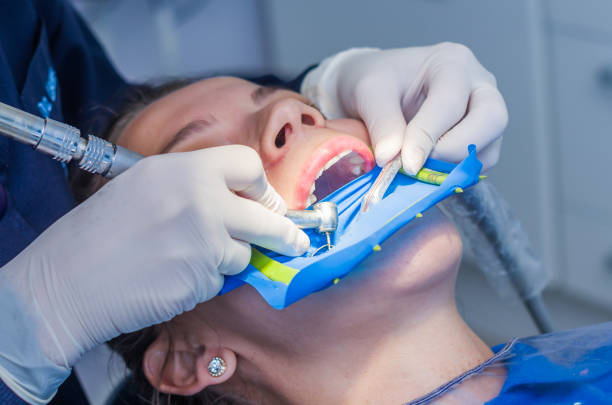 istock Great concept of dental procedure 923023034