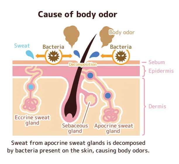 Vector illustration of Cause of body odor illustration (English)