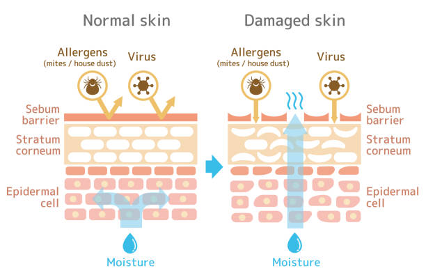 ilustraciones, imágenes clip art, dibujos animados e iconos de stock de vista seccional de la skin.comparison ilustración del efecto de protección entre la piel sana y heridas de la piel. - dermis