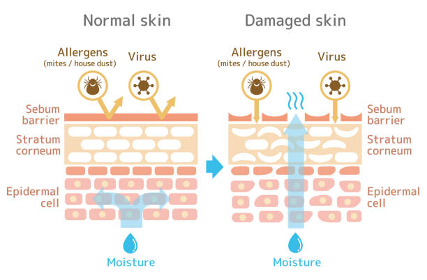Sectional view of the skin.Comparison illustration of protection effect between healthy skin and wounded skin. Sectional view of the skin.Comparison illustration of protection effect between healthy skin and wounded skin. With text. skin stock illustrations