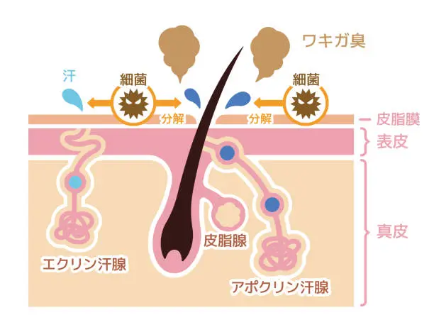 Vector illustration of Cause of body odor illustration (Japanese / No explanation text)
