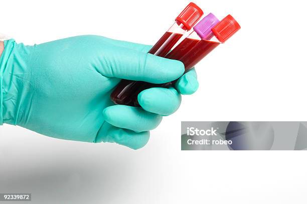 Próbki Krwi - zdjęcia stockowe i więcej obrazów Analizować - Analizować, Badania, Badanie krwi - Test medyczny