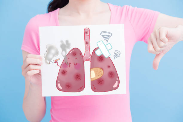 istock woman take unhealth lung billboard 923618992