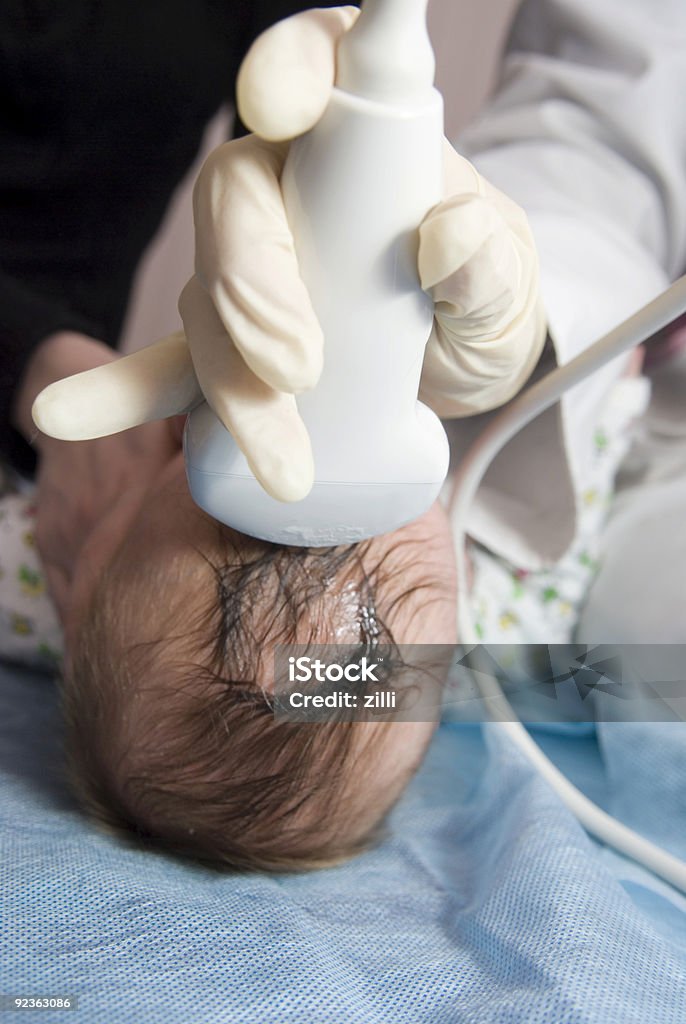 Scanner la tête de l'enfant - Photo de Bébé libre de droits