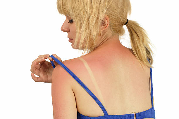 Rear view of woman moving shirt strap to look at her sunburn stock photo