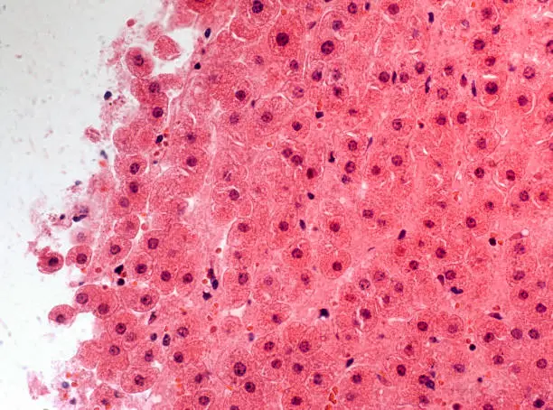 Photo of High scale magnification of liver cells