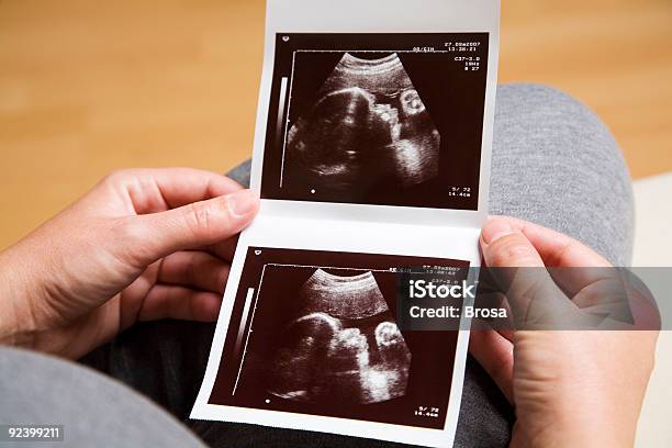 초음파 스캔 초음파에 대한 스톡 사진 및 기타 이미지 - 초음파, 아기, 인쇄물