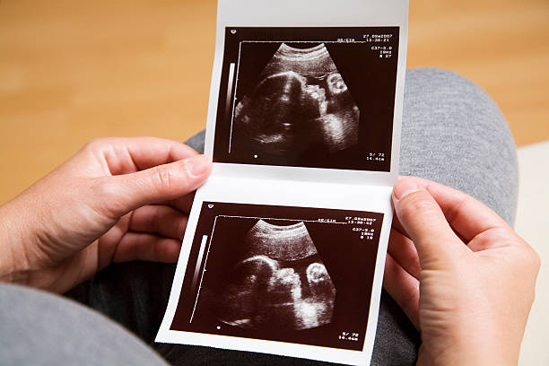 Two black and white pregnancy ultrasound scan pictures