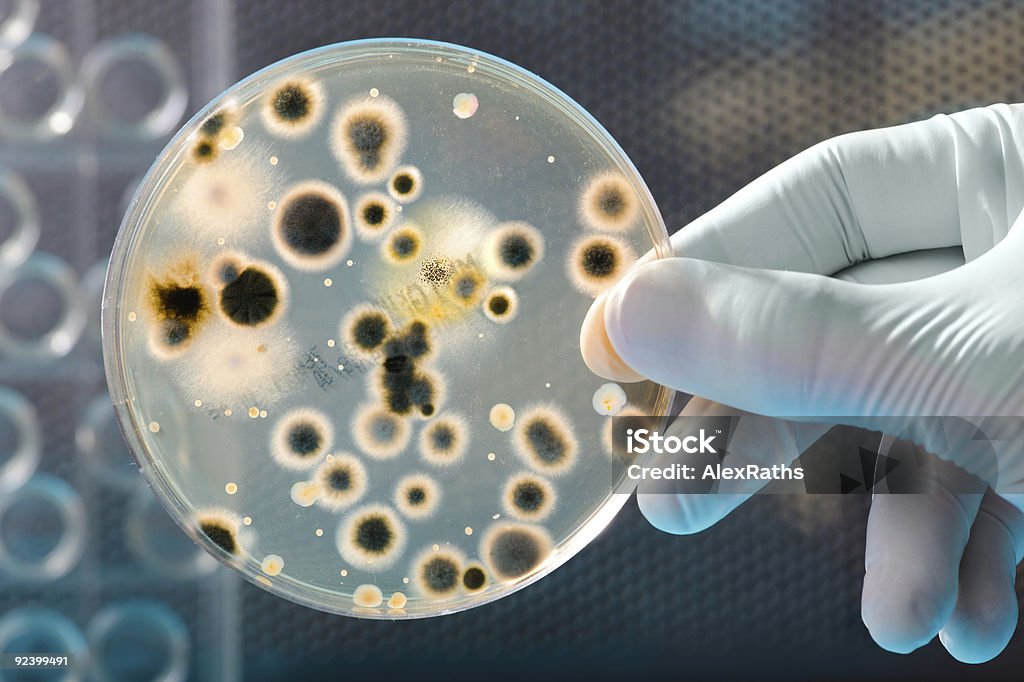 bacteria culture  Agar Jelly Stock Photo