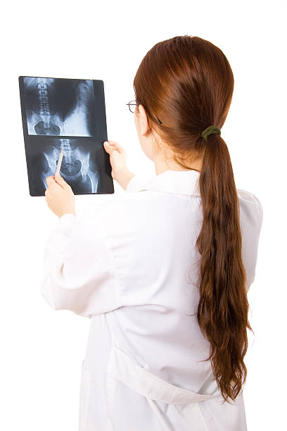 médica examinando uma radiografia - x ray image coccyx radiologist hip imagens e fotografias de stock