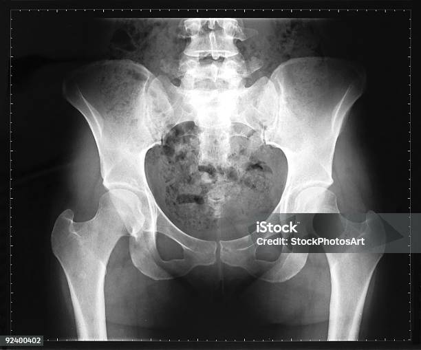 Raiosx Da Pelve E Coluna Vertebral Feminino - Fotografias de stock e mais imagens de Imagem de raios X - Imagem de raios X, Cóccix, Mulheres