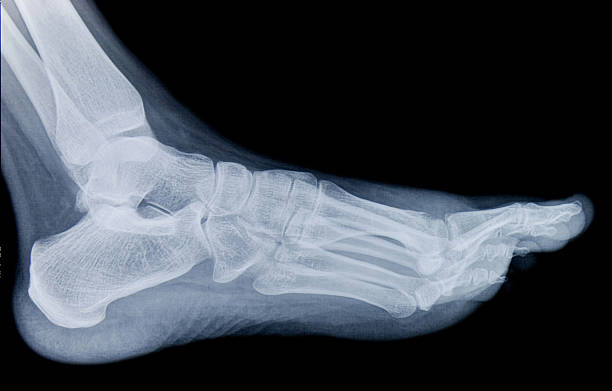 menschlicher fuß x-ray - bending human foot ankle x ray image stock-fotos und bilder