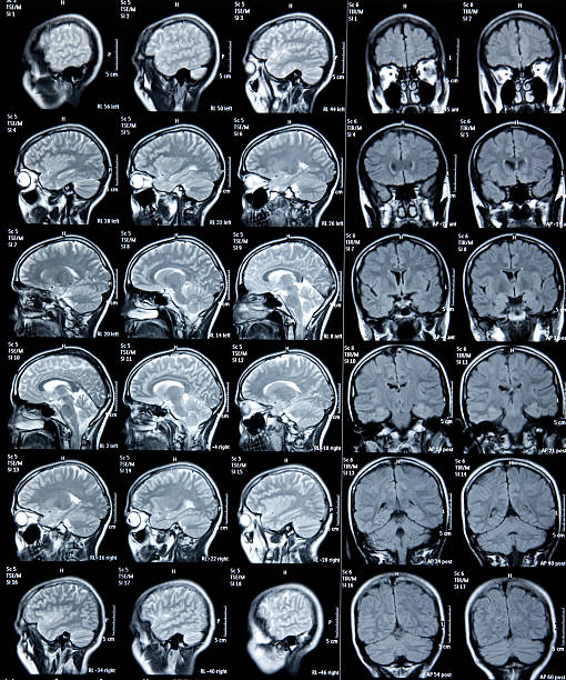 400+ Ct Scan Results Stock Photos, Pictures & Royalty-Free Images - iStock