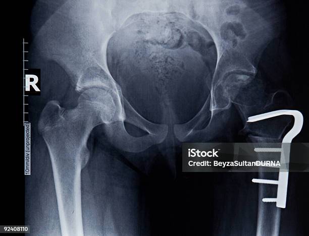 Vita Uomo - Fotografie stock e altre immagini di Acetabolo - Acetabolo, Anatomia umana, Anca