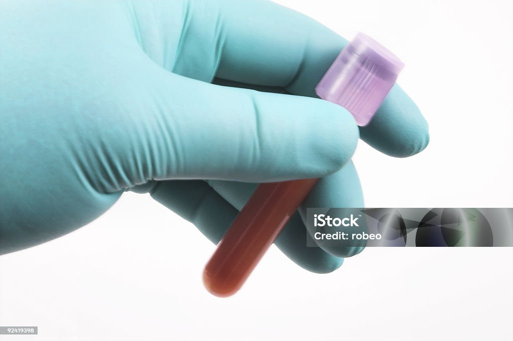 Bluttest - Lizenzfrei Analysieren Stock-Foto