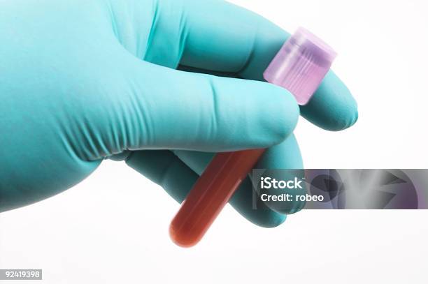 Foto de Amostra De Sangue e mais fotos de stock de Analisar - Analisar, Análise ao sangue, Biologia
