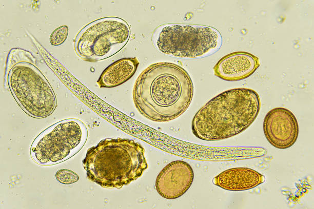 istock Mixed of helminths in stool 924341350