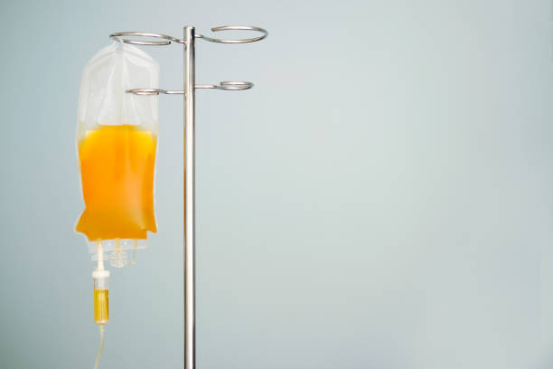 transfusion of fresh frozen plazma (ffp), bag on stand transfusion of fresh frozen plazma (ffp), bag on stand blood plasma photos stock pictures, royalty-free photos & images
