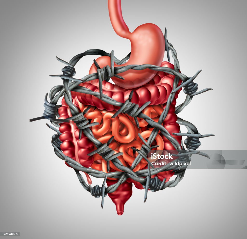 Painful Digestion Painful digestion IBS or irritable bowel syndrome and intestine pain or Intestinal discomfort inflammation problem or constipation as barbed wire with 3D illustration elements. Irritable Bowel Syndrome Stock Photo