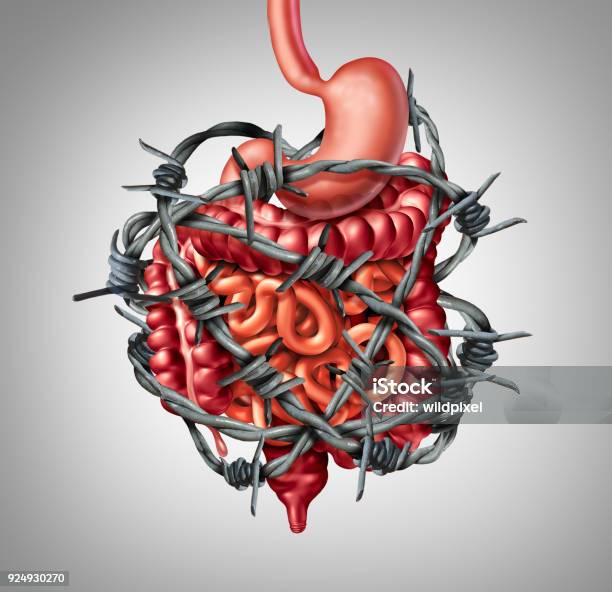 Painful Digestion Stock Photo - Download Image Now - Irritable Bowel Syndrome, Constipation, Intestine