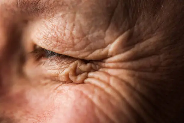 A middle-aged, blue-eyed, Caucasian person's eye looks to the side while smiling with wrinkled skin.