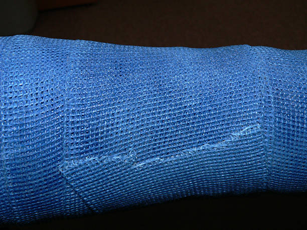 Blue cast up close stock photo