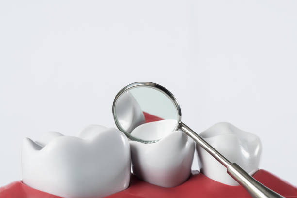 istock Dental equipment 925160386