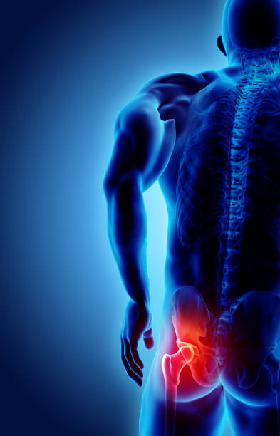 istock Hip painful skeleton x-ray, 3D illustration. 925276130