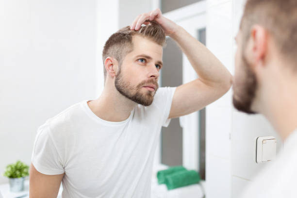 gut aussehender junger mann besorgt über hairloss - glatzenbildung stock-fotos und bilder