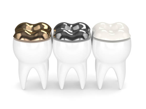 istock 3d render of teeth with different types of dental filling 925339622