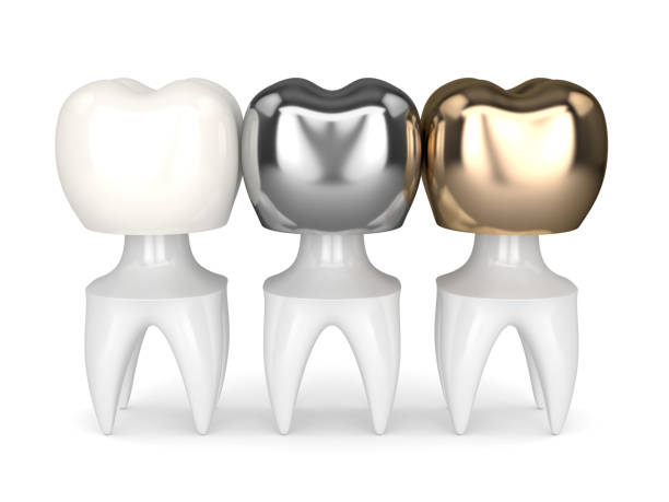 istock 3d render of teeth with different types of dental crown 925348424