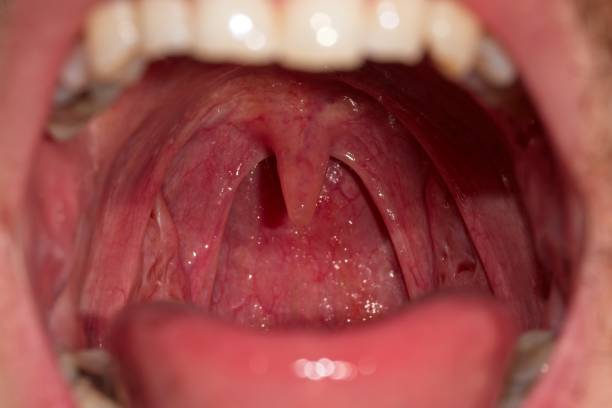 primo stato della bocca e dei denti - ugola foto e immagini stock