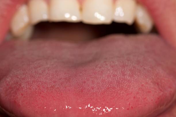 istock Close up of mouth and teeth 925476726