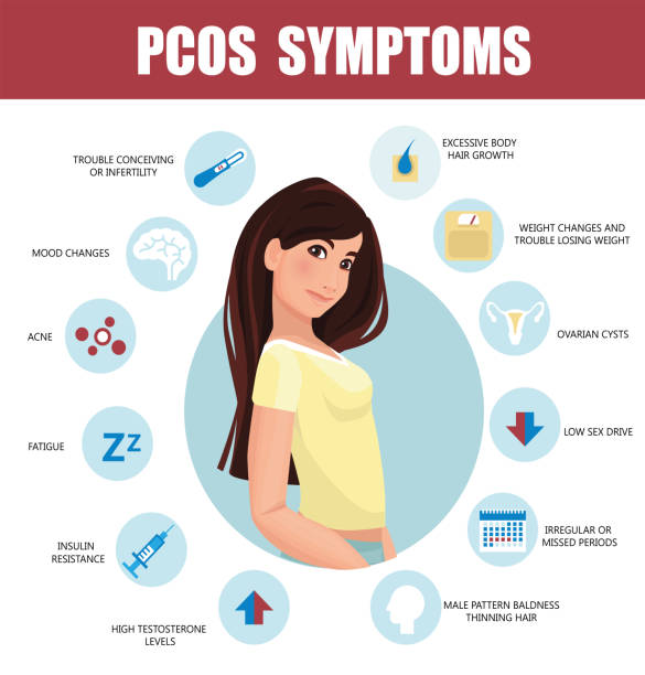 PCOS Symptoms infographic PCOS Symptoms infographic. Detailed vector Infographic. Women Health Ovulation stock illustrations