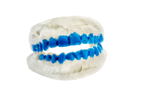 Plaster Dental Mold With Blue Painted Teeth Stock Photo - Download Image  Now - Anatomy, Blue, Color Image - iStock