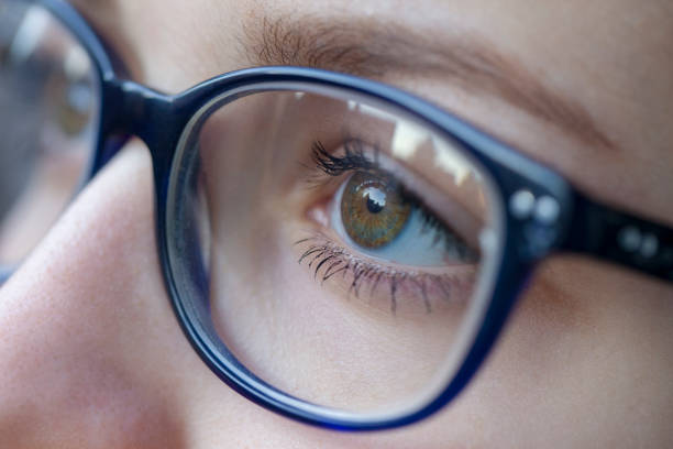 istock Macro eye-contact lens 925981344