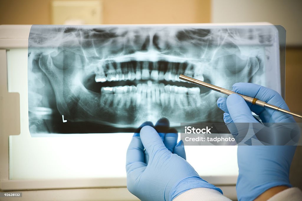 Dental X-Ray - Lizenzfrei Zahnwurzel Stock-Foto