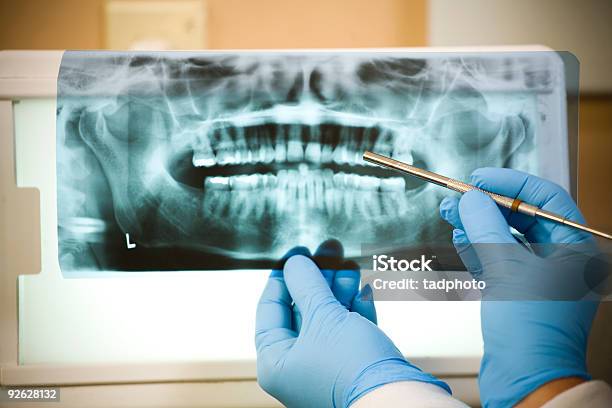 Dental Xray Stockfoto und mehr Bilder von Zahnwurzel - Zahnwurzel, Endodontie, Gesundheitswesen und Medizin