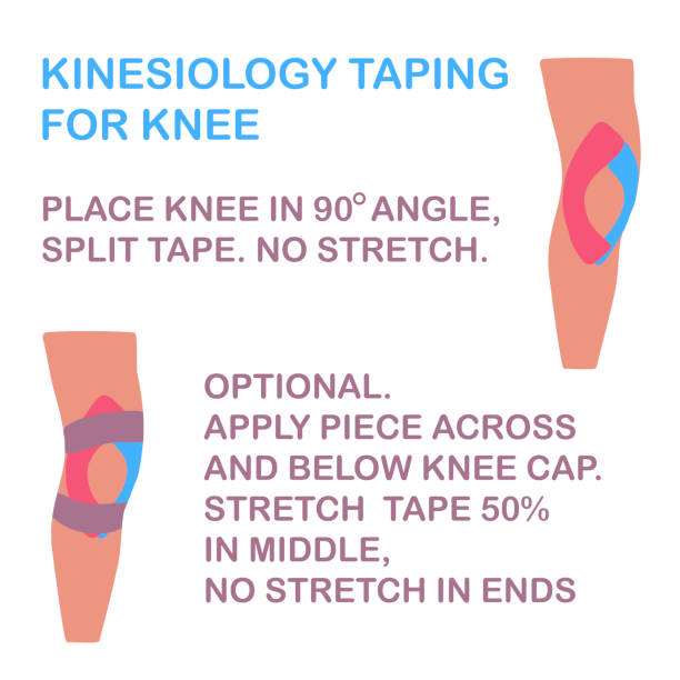Medial Illustration Kinesiology taping for knee. No stretch tape. Vector illustration sports medicine stock illustrations